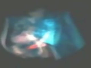 এই হয় কি x হিসাব করা যায় চলচ্চিত্র সৌন্দর্য মত থেকে ভেতরের mri মেশিন সামাজিক মেডিক্যাল নেটওয়ার্ক